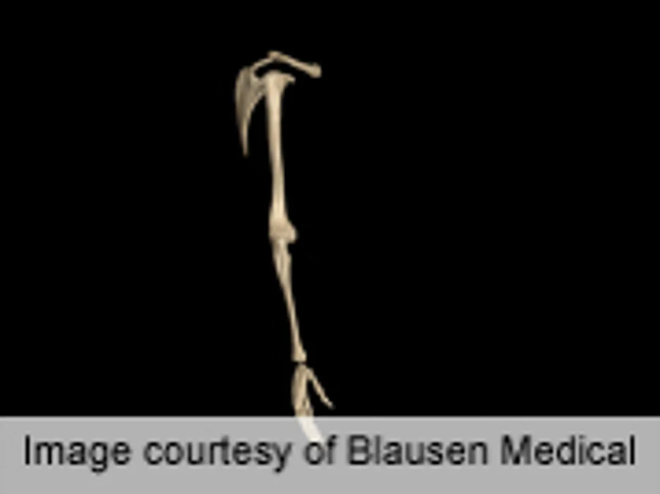 Inadequate Pain Meds in ER for Patients With Long-Bone Fx
