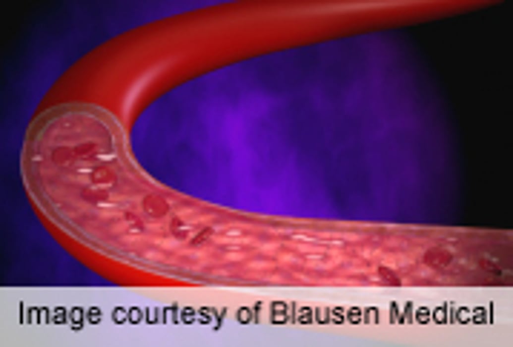 Better Outcomes With Consistent BP Control Post-Stroke