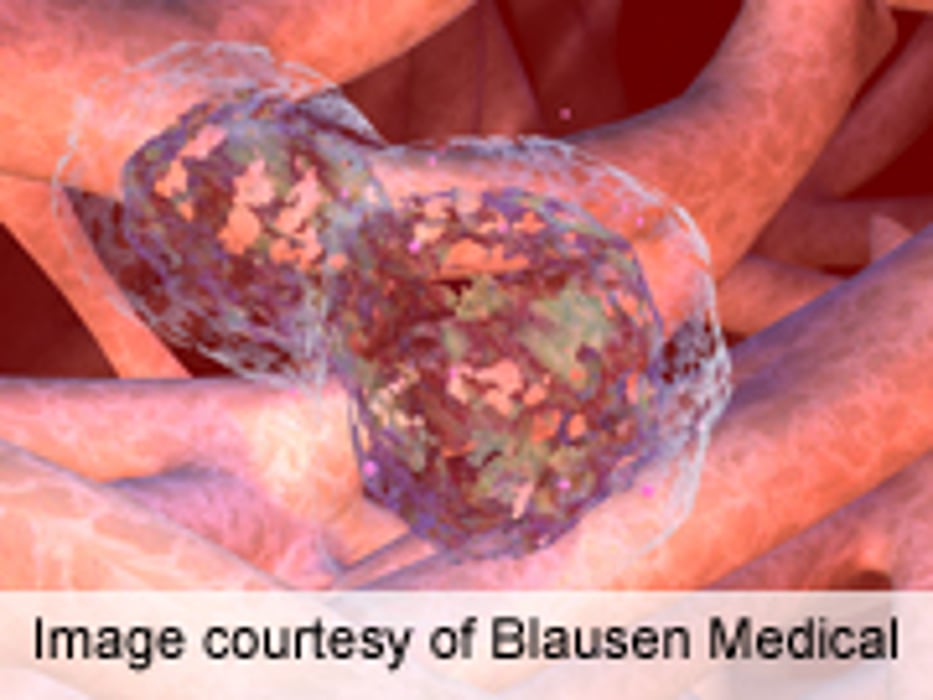 Wild Berry May Boost Effect of Chemo for Pancreatic Cancer