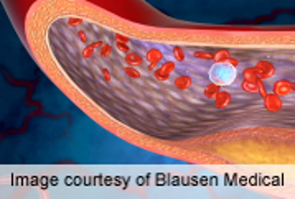 Plavix's New Generic Status Could Be Boon for Patients