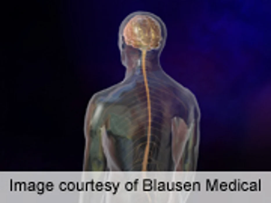 Brain Scans May Explain Thinking, Memory Problems in Some MS Patients