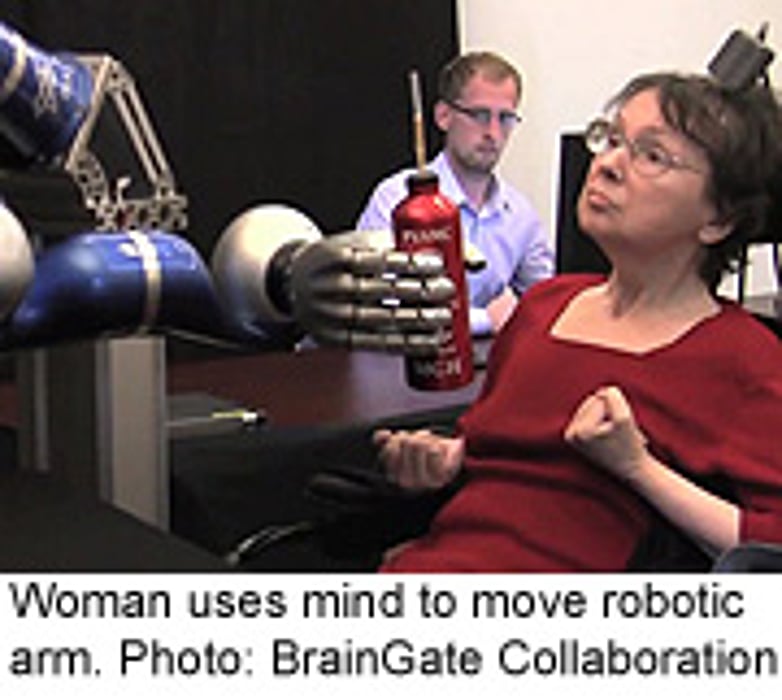 Paralyzed Patients Use Mind to Move Robotic Arm