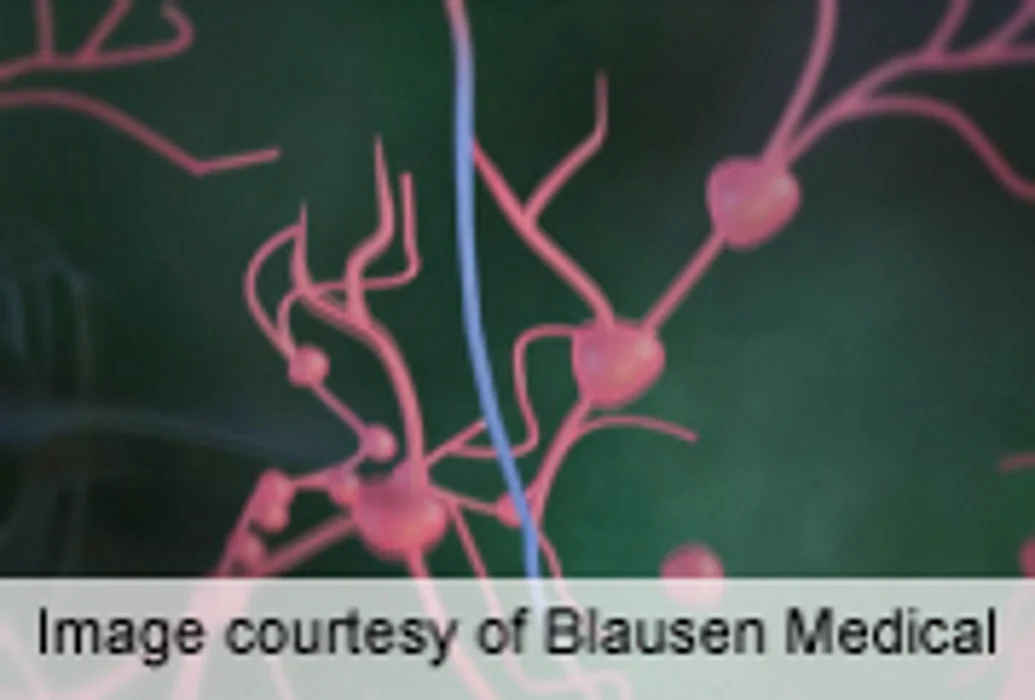 Metastatic Melanoma Responds to First-Line Interleukin-21