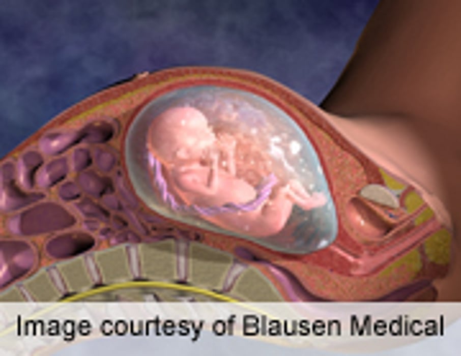 Teen Pregnancies Down; Rates Up for Older Women in 2008