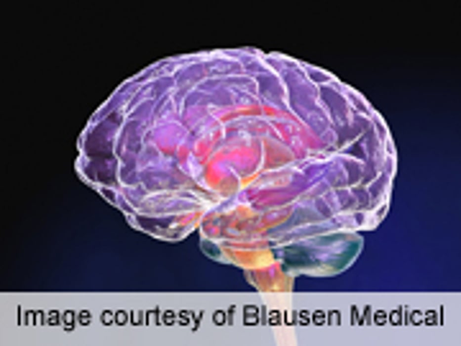 High Sensitivity for Ottawa Subarachnoid Hemorrhage Rule