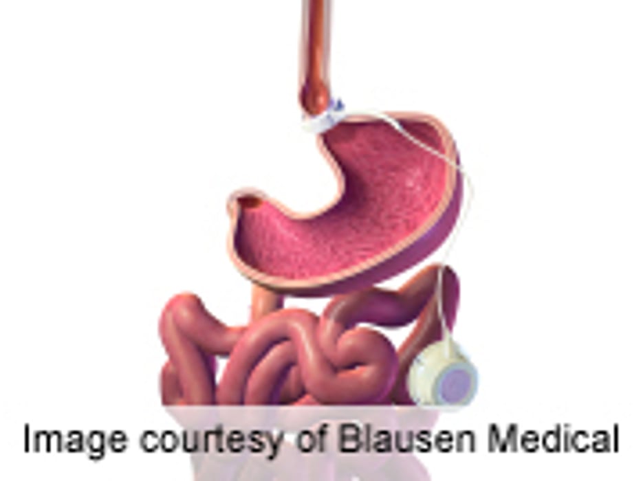 Celiac Disease Down for Swedish Youth Born in 1997 Versus 1993