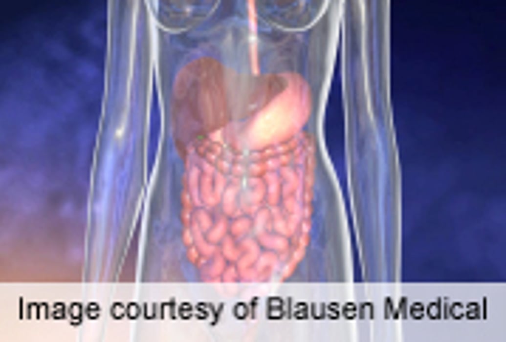 No Association Seen Between Celiac Disease, Autism Disorders