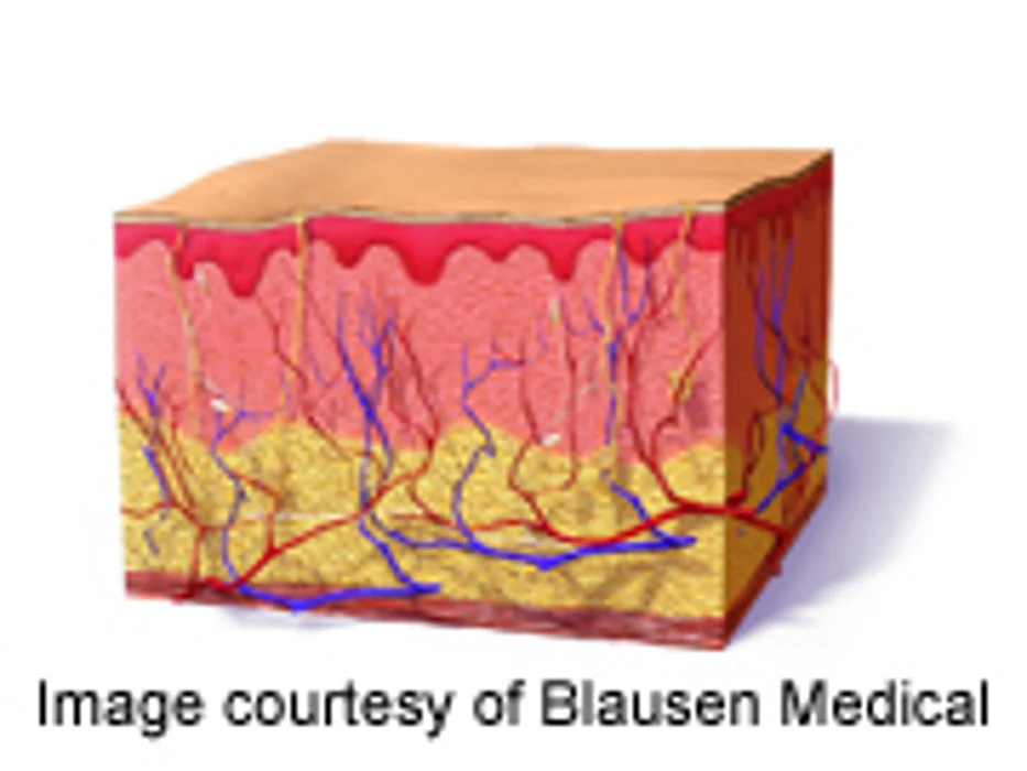 New 'Bioengineered Skin' Gets Closer to the Real Thing