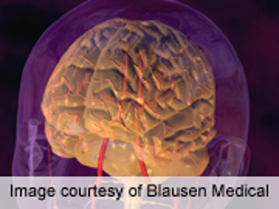 Diabetes Linked to Cognitive Decline in Older Adults