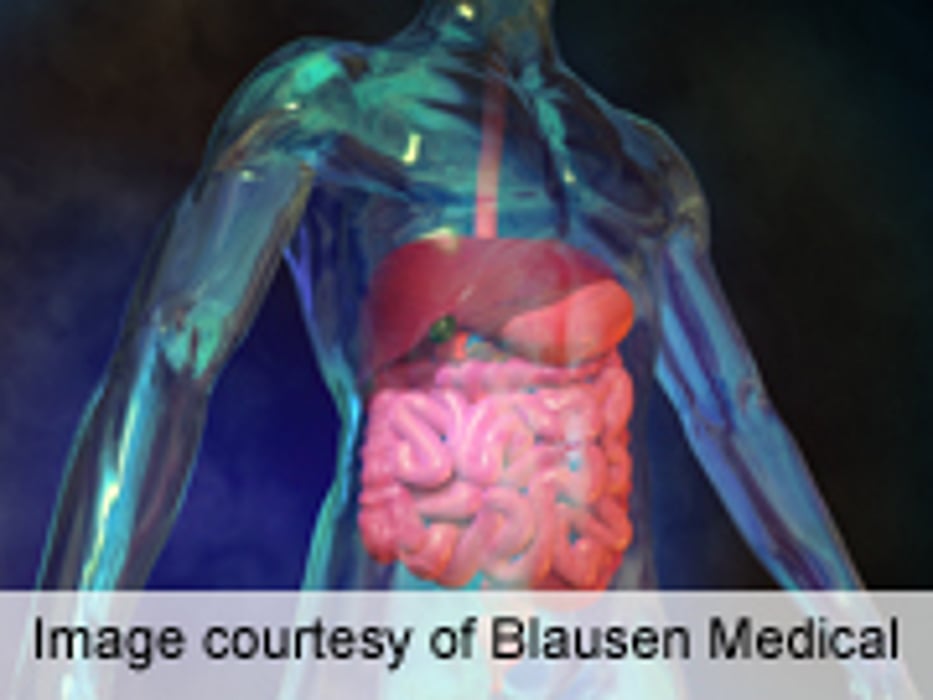Regorafenib Efficacious in GI Malignant Disease