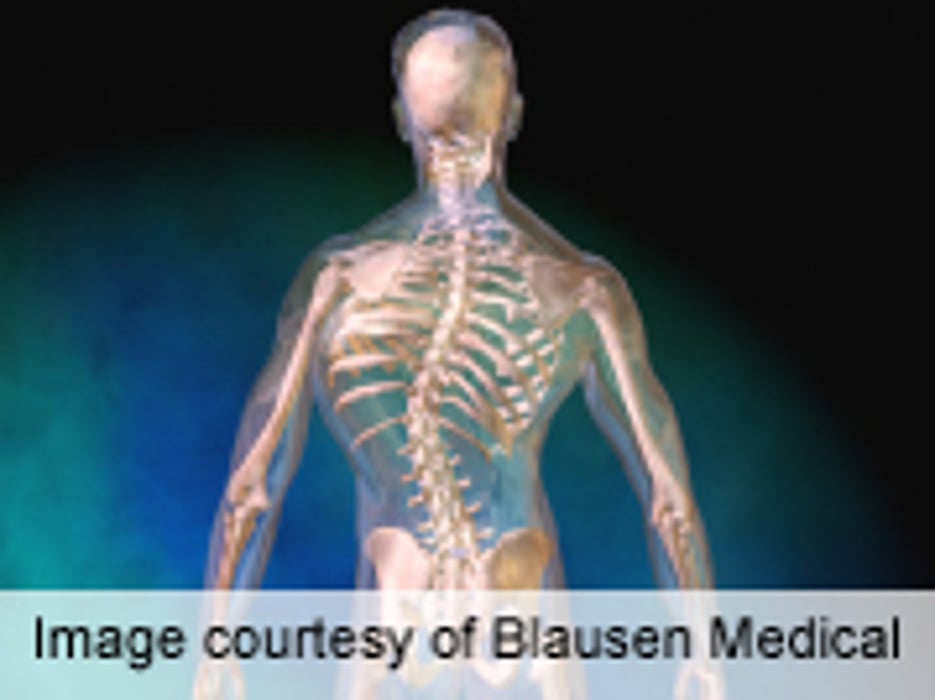 14.4% of Kids' Scoliosis Surgeries Have In-Hospital Complications
