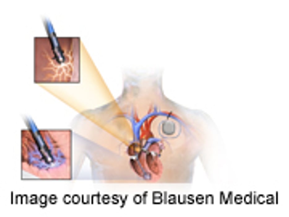 Pacemakers, Defibrillators Sources of Deadly Infections: Study