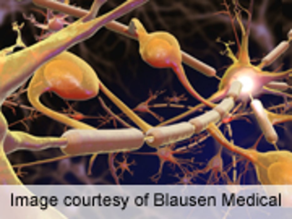Sleep Apnea Linked to Diabetic Peripheral Neuropathy
