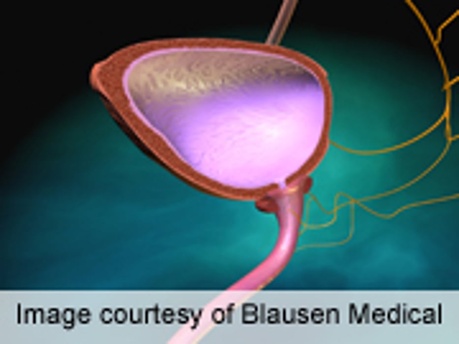 Women Can Waive Test Before Incontinence Surgery: Study