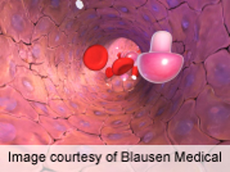 Rare Cancer Syndrome Linked to Lower Diabetes Risk