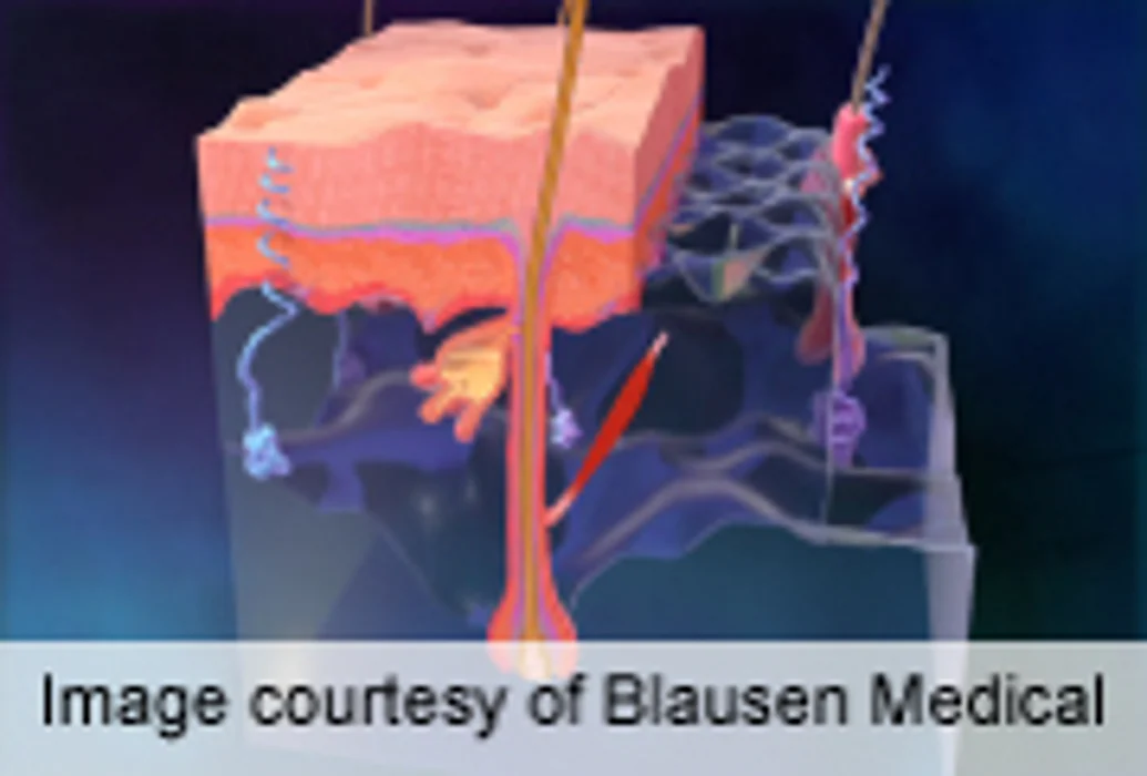 Eccrine Sweat Glands Play Role in Human Wound Repair