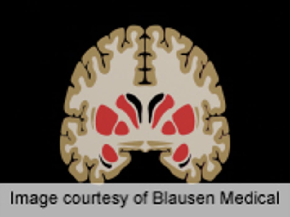Karate Black Belts Have Differences in Brain Structure