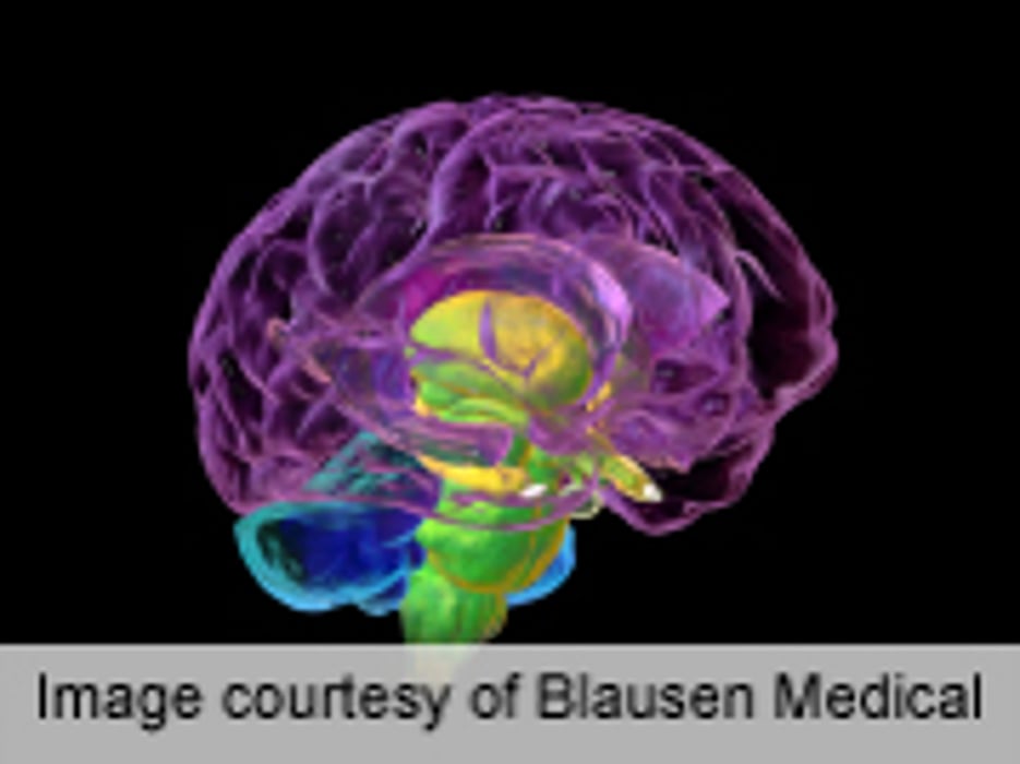 High IgE Levels Inversely Associated With Risk of Glioma