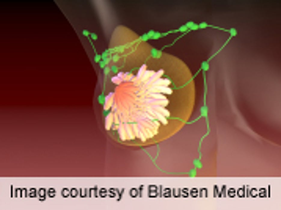 Contralateral Prophylactic Mastectomy Benefit Questioned