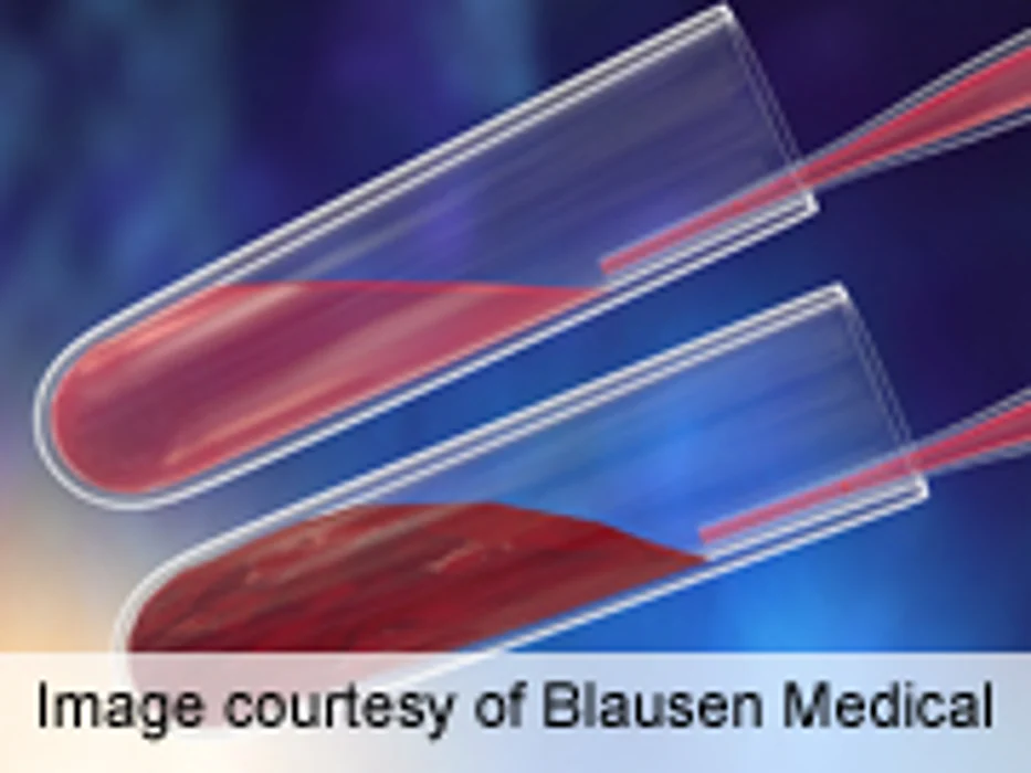 Could Bloodletting Ease Heart Risks for the Obese?