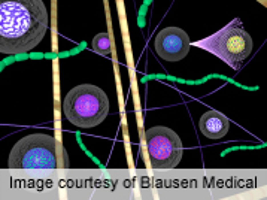 Drug-Resistant Bacteria Spread Regionally Through Hospitals
