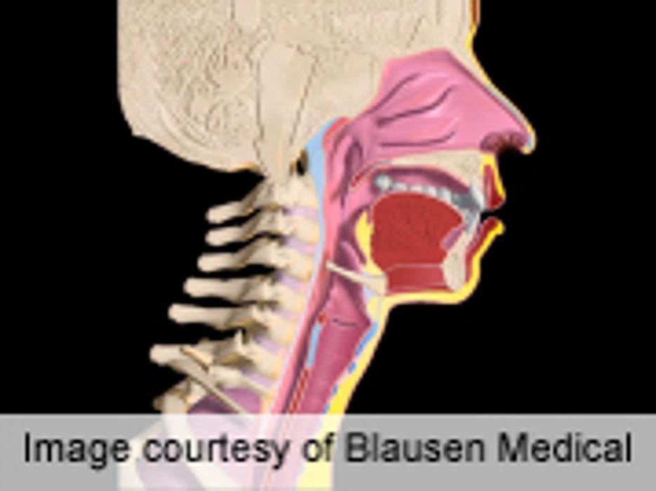 Docs Face Challenges Treating HPV Oropharyngeal CA Patients