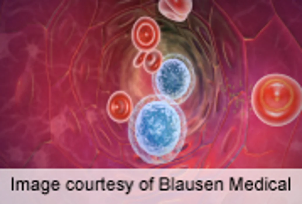 Autoantibodies Detectable Long Before Symptom Onset