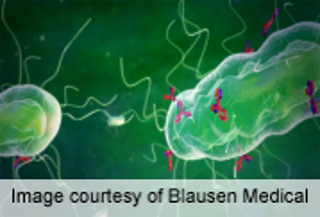 Elevated Antibody Component Tied to Worse General Survival