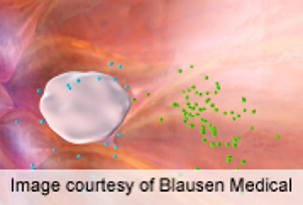 Aspirin Ups Risk of Bleeding in All But Diabetes Patients