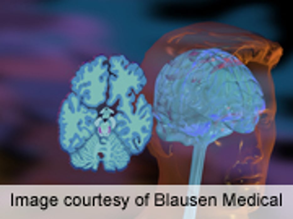 Exercise, Drugs Compared for Depression Tx in CHD Patients