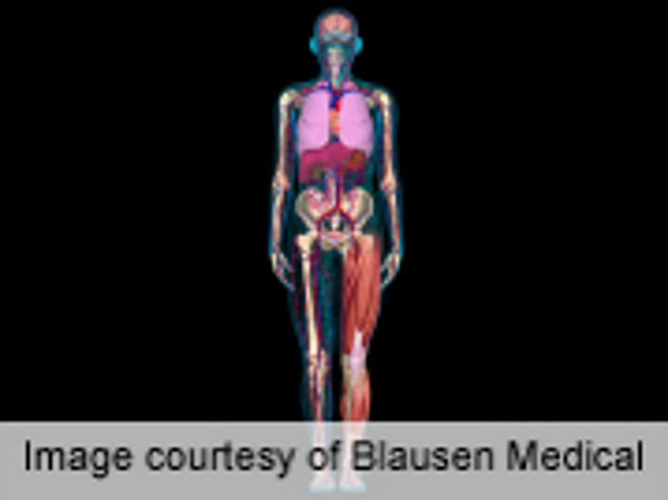 Stem Cells May Offer Survival Benefit for Systemic Sclerosis