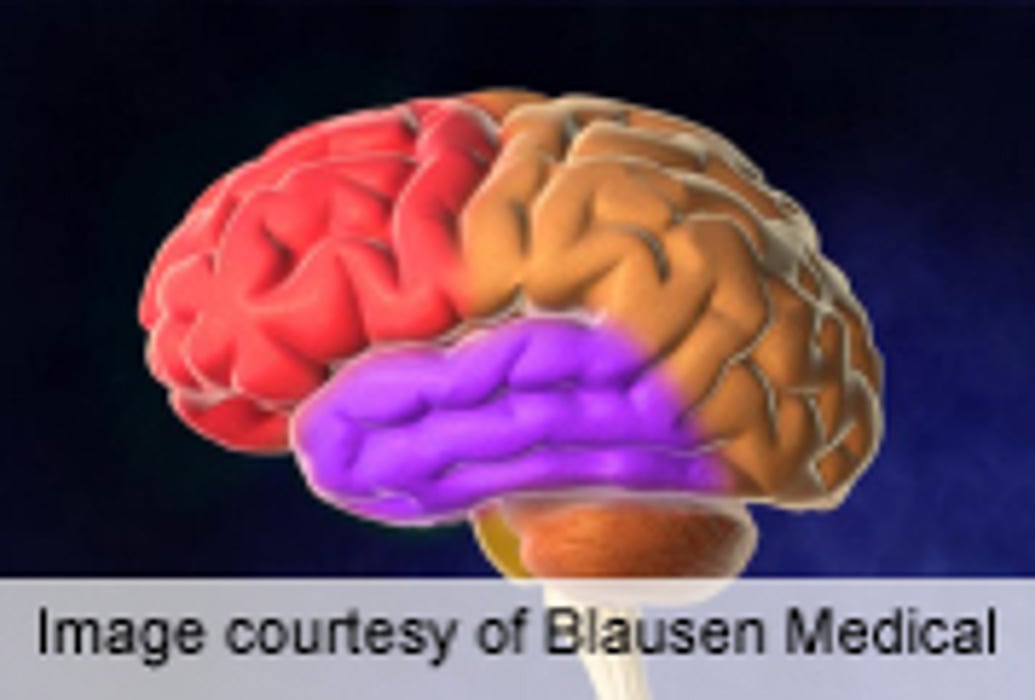 Cardiovascular Disease Linked to Cognitive Decline in Older Women