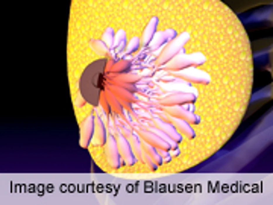 ACS: Vaccinia Virus Studied for Triple-Negative Breast Cancer
