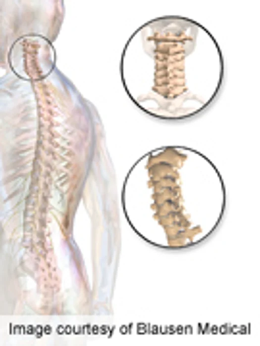 ProDisc-C Device Doesn't Change Facet Joint Pressures