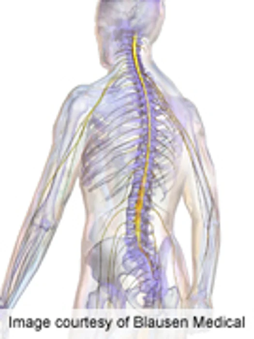 Risk Factors for Tracheostomy in Spinal Cord Injury Identified
