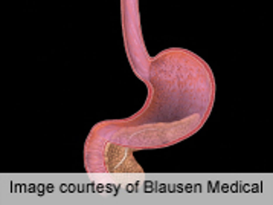 New Therapies Show Some Promise Against Pancreatic Cancer