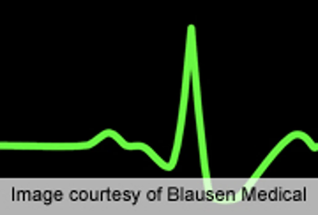 Benefit of Noninvasive Tests in Non-MI Chest Pain Questioned