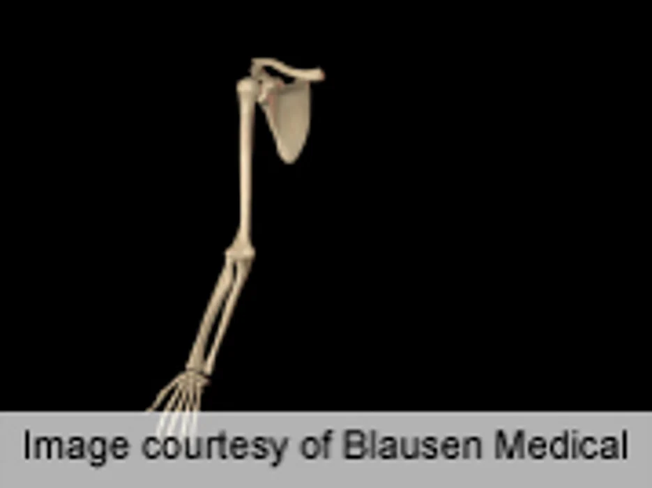 Poorer Bone Health Seen in Black Children With Fractures