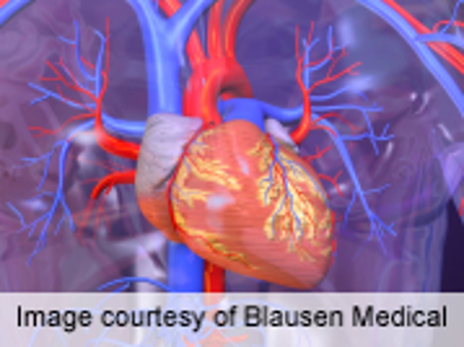 Long-Term Use of Sulfonylureas Tied to Coronary Heart Disease