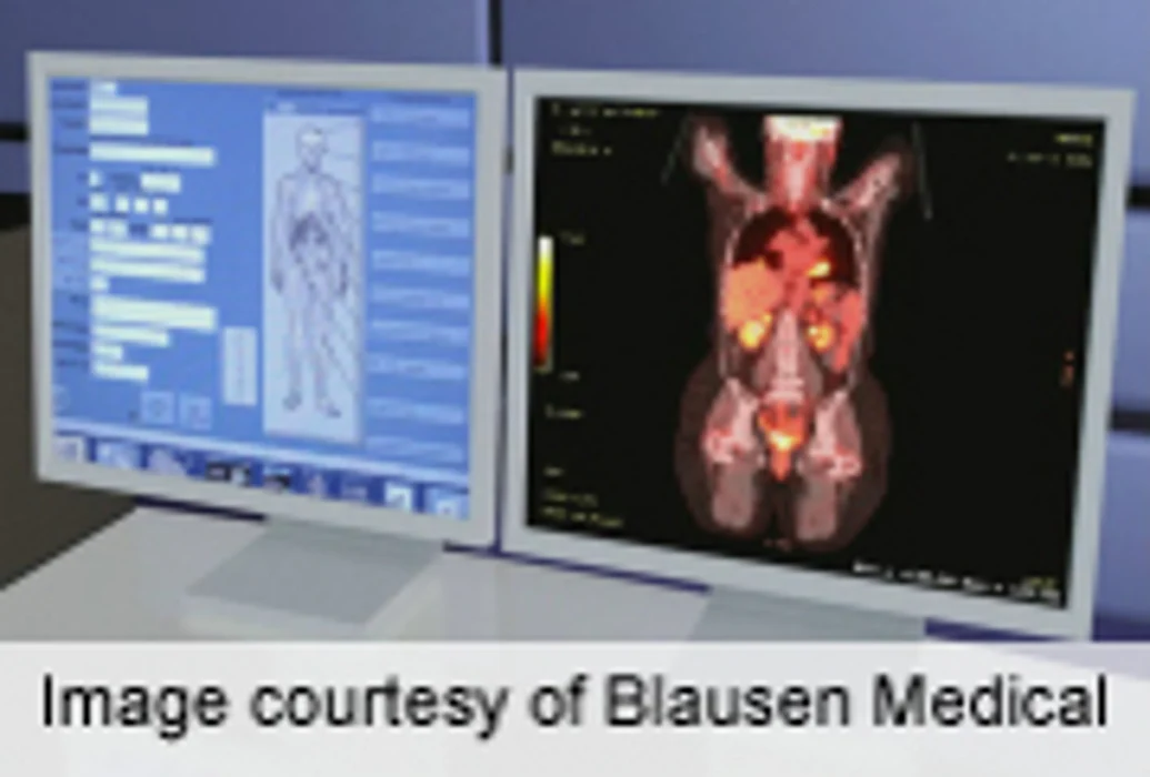 Advanced Imaging, Radiation Exposure Up Over Last Decade