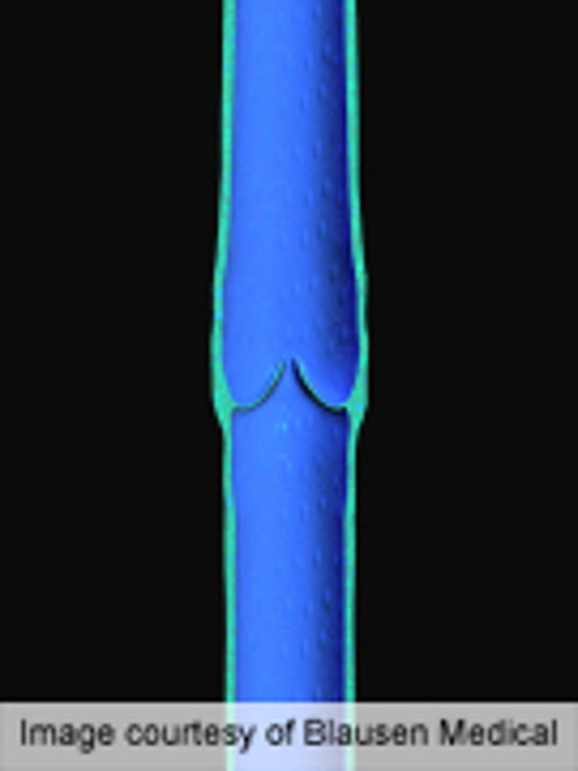 Infrapopliteal Nitinol Stent Safe for Critical Limb Ischemia
