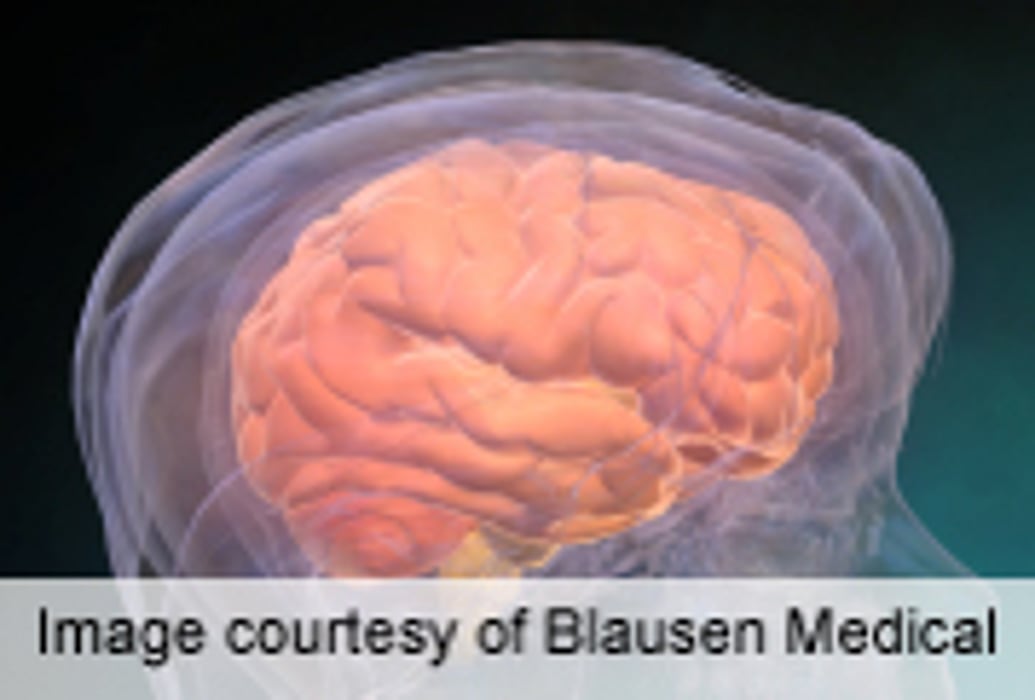 Cognitive Rest May Speed Concussion Recovery in Youth