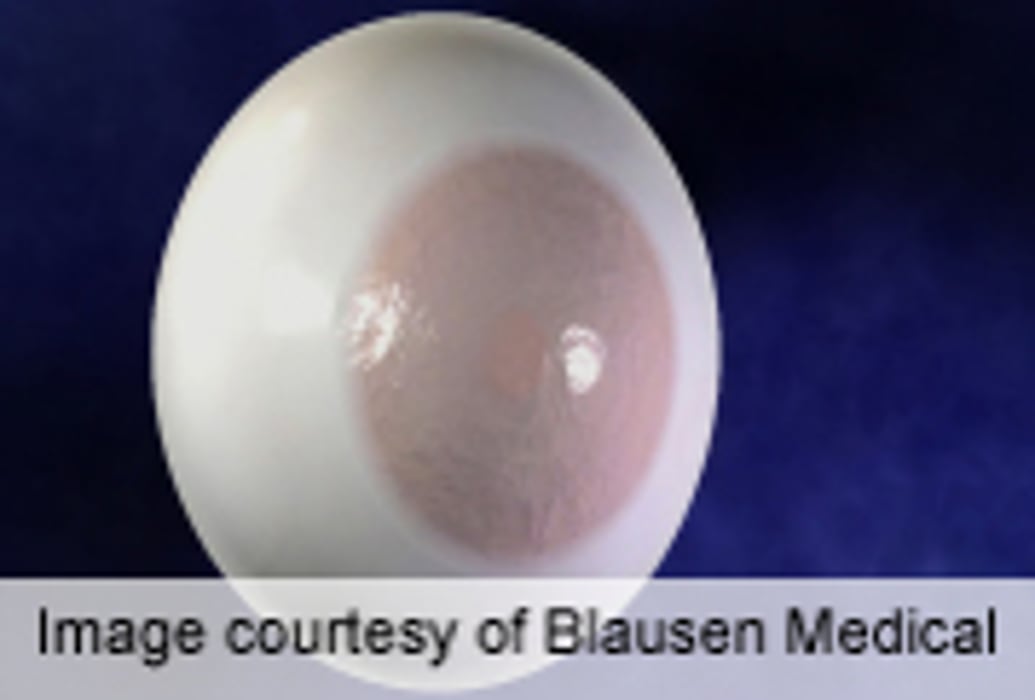 Corneal Cell Transplant Can Restore Corneal Transparency