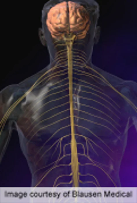 Exercise Benefits Physical Functioning in Alzheimer's