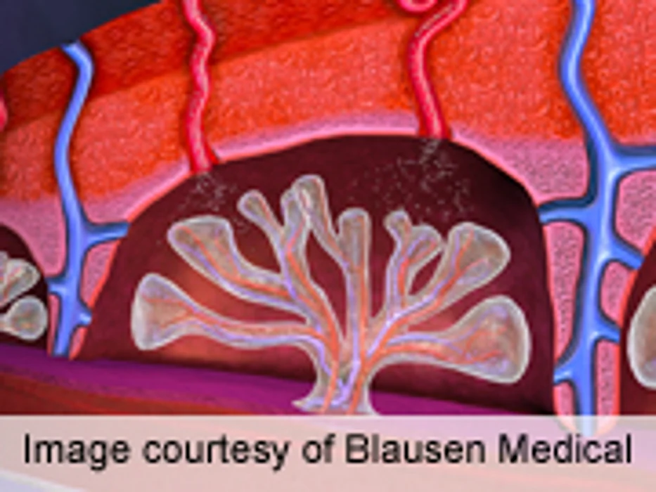 Hemoglobin A1C Inadequate for Postpartum Diabetes Screening