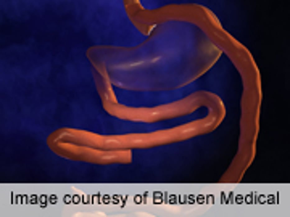 Bariatric Surgery Cuts Incidence of Type 2 Diabetes in Obese