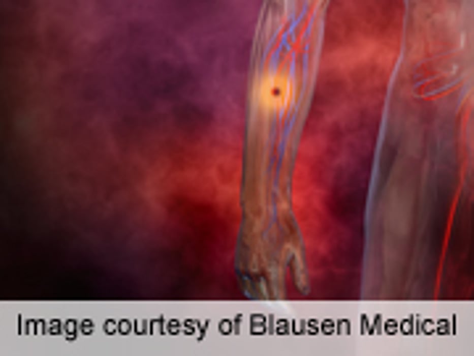 Quick-Reversal Method May Be at Hand for New Blood Thinner