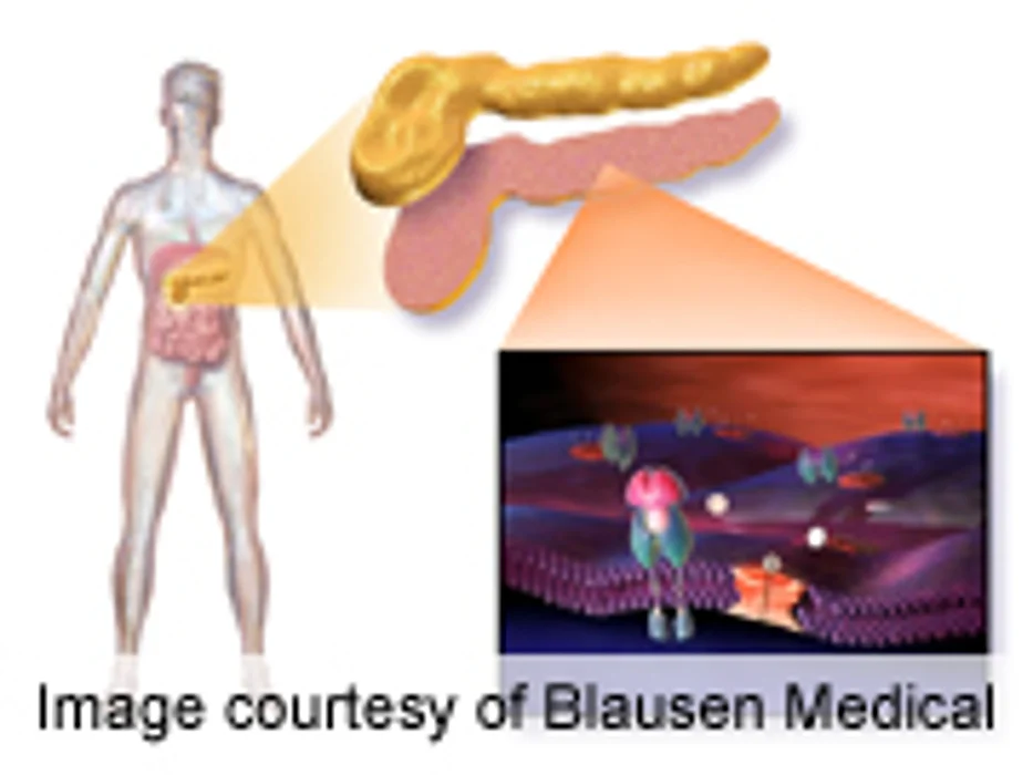 Early Loss of Glucagon Response to Hypoglycemia Found in Teens