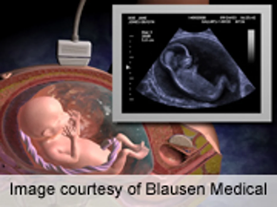 Fetal Heart May Develop Later in Pregnancy Than Thought