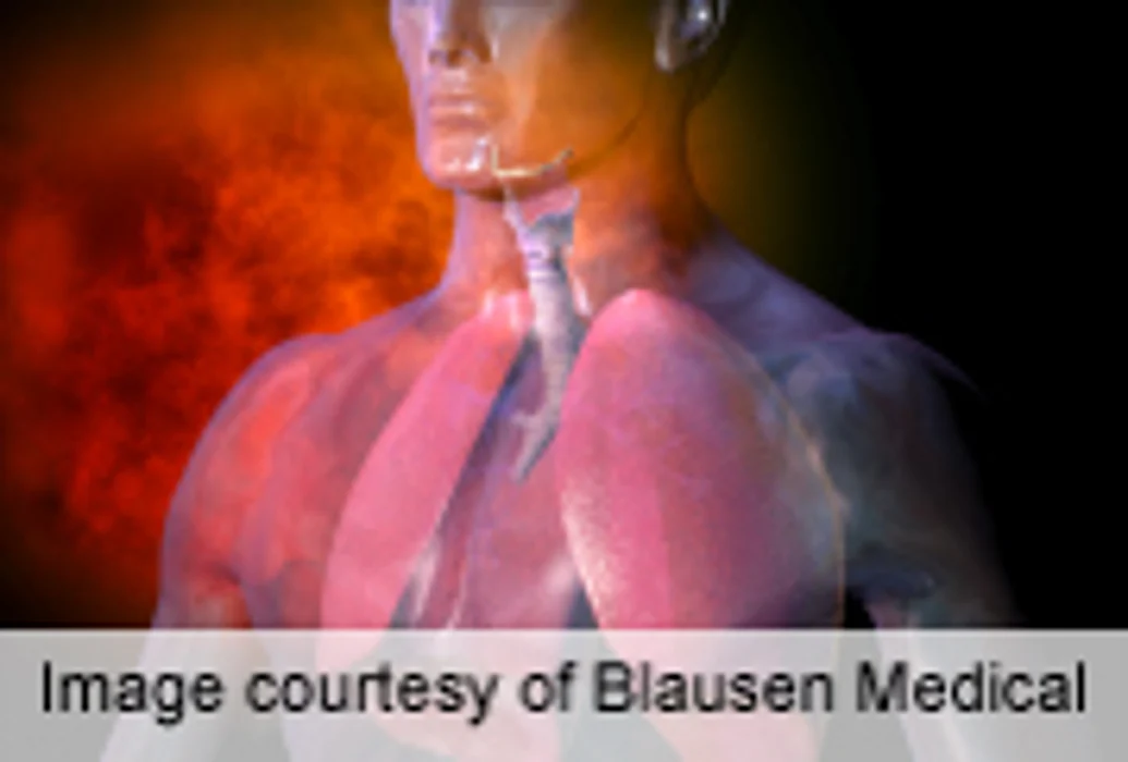Research Supports Role of BMI in Incident Asthma in Children
